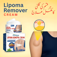 Herbal Lipoma Removal Cream – ہر قسم کی گلٹی کے لیے نیچرل فارمولا