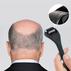 Derma Roller & Ginger Hair Oil