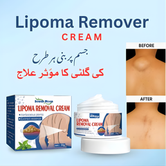 Herbal Lipoma Removal Cream – ہر قسم کی گلٹی کے لیے نیچرل فارمولا